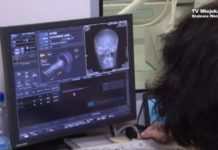 Start diagnostyki obrazowej w szpitalu