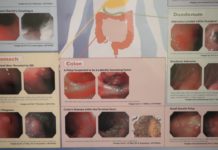 Wstyd się wstydzić, czyli zbadaj jelito grube