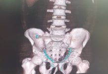 Chirurgia kręgosłupa w stalowowolskim szpitalu