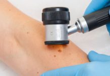 Kampania „Razem dla zdrowia-Czerniak”